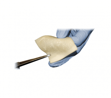 Soft Tissue Allografts